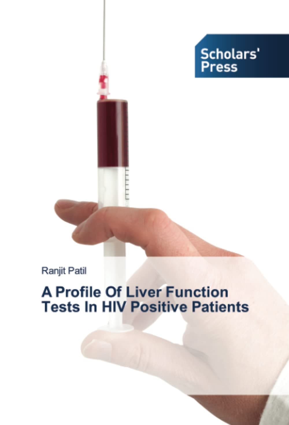 A Profile Of Liver Function Tests In HIV Positive Patients