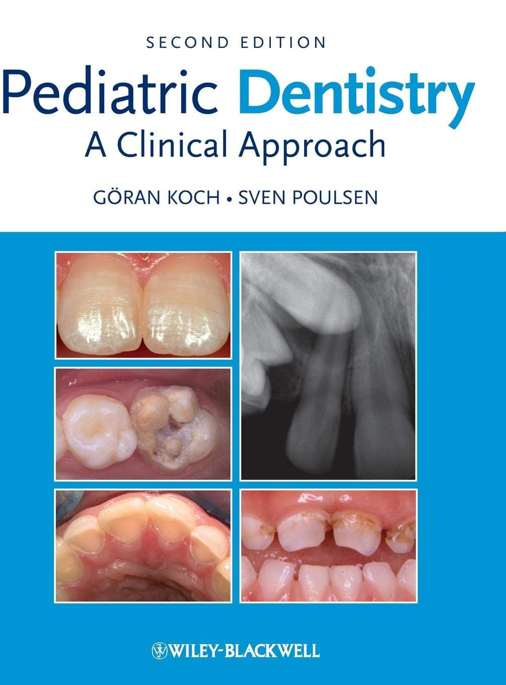 Pediatric Dentistry: A Clinical Approach 2nd Edition