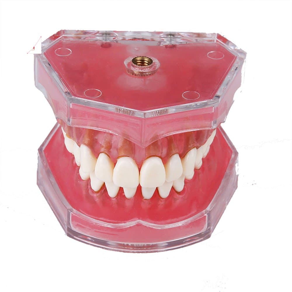 Dental standard orthodontic plastic teeth model 4004 with 28 removeable teeth Soft gums
