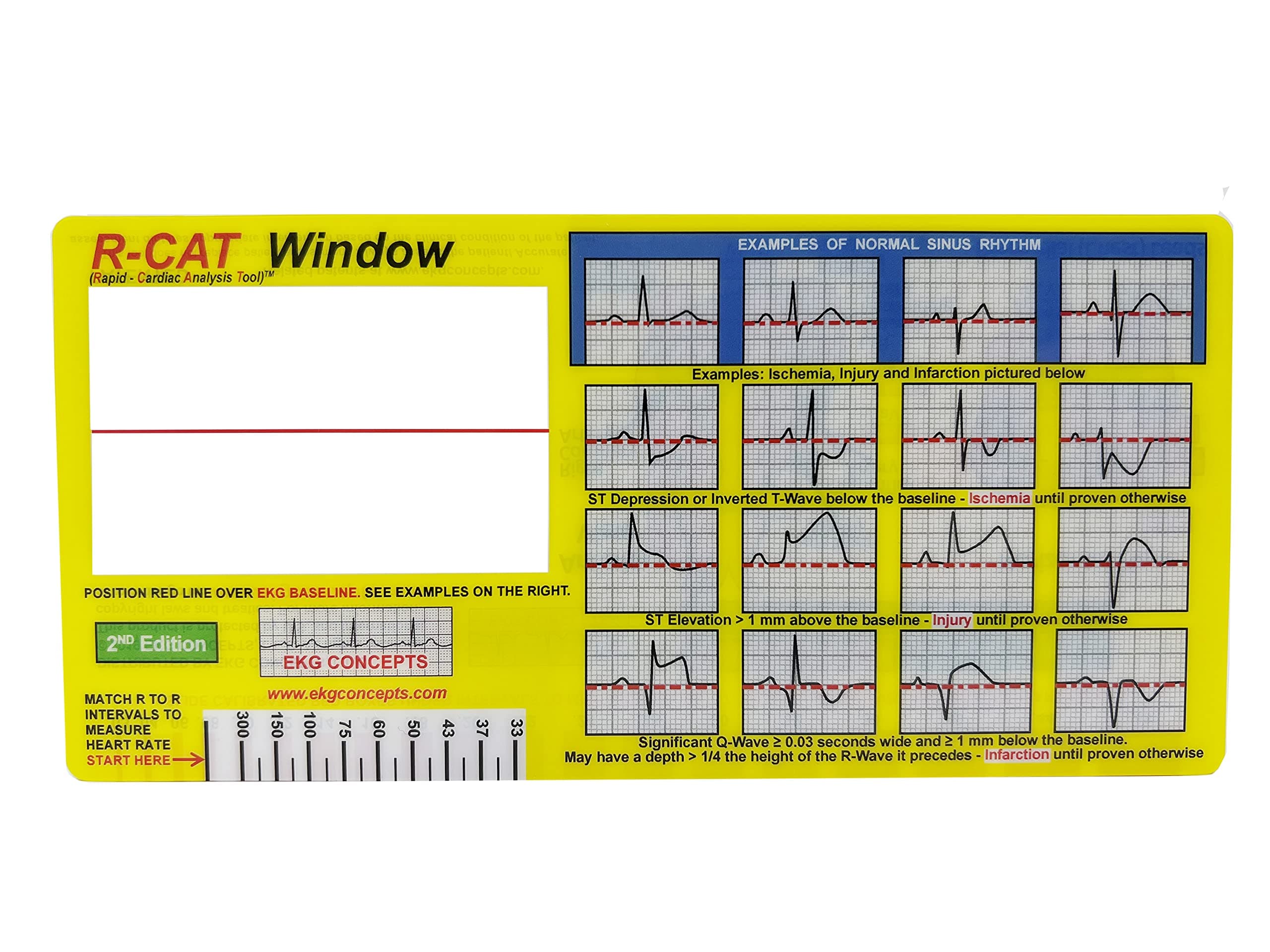R-CAT EKG Window 2nd Edition