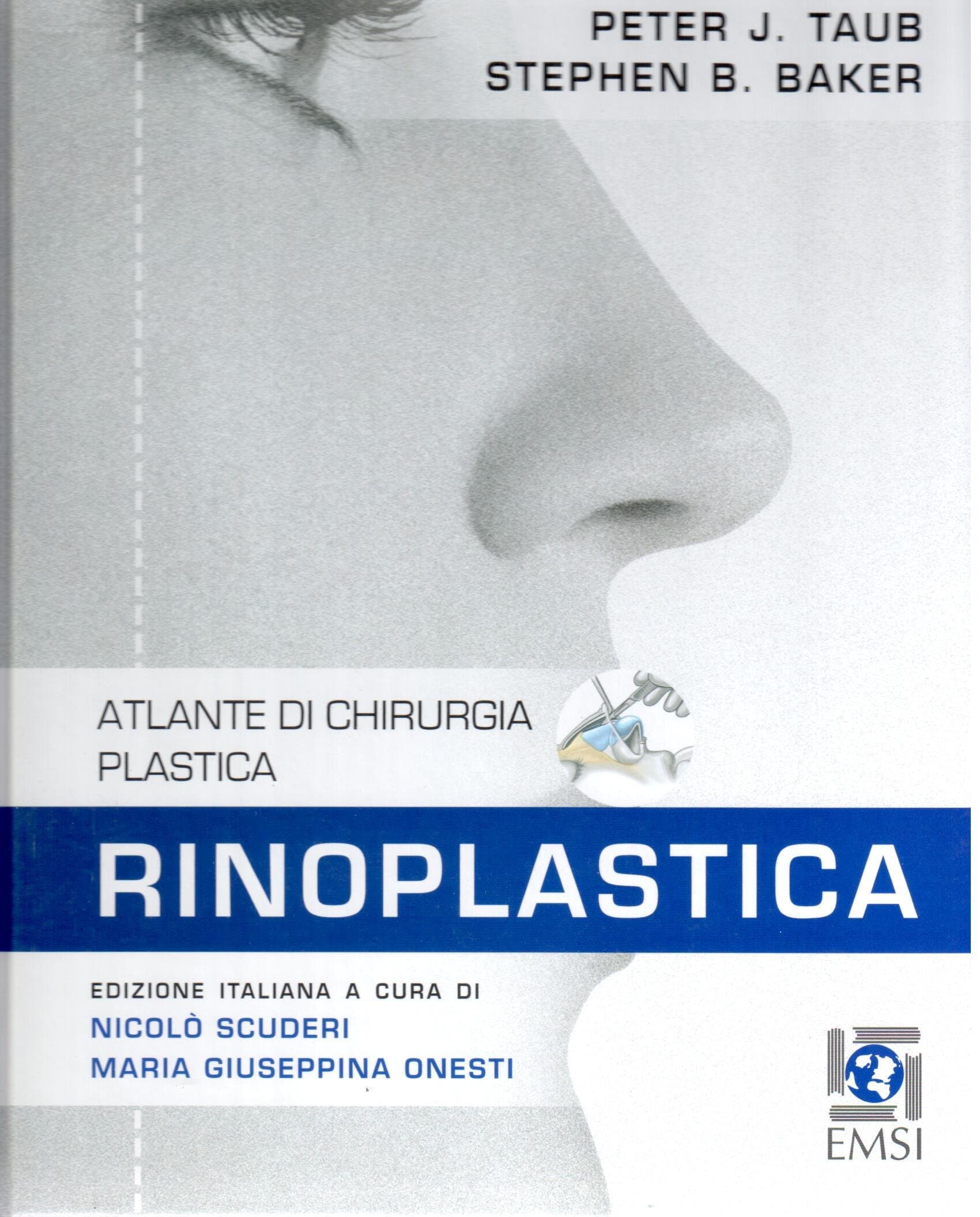 RINOPLASTICA ATLANTE CHIRURGIA PLASTICA