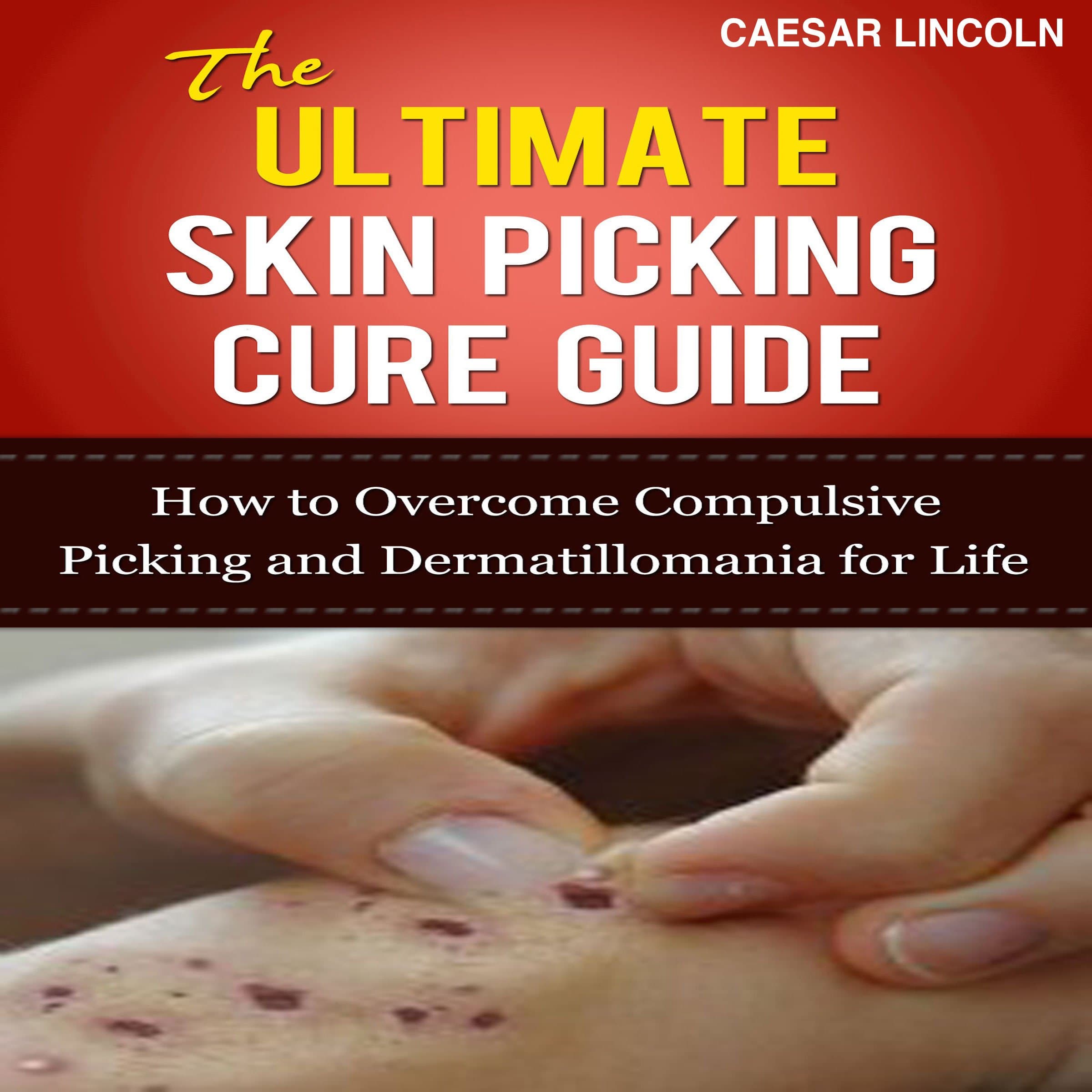The Ultimate Skin Picking Cure Guide: How to Overcome Compulsive Picking and Dermatillomania for Life