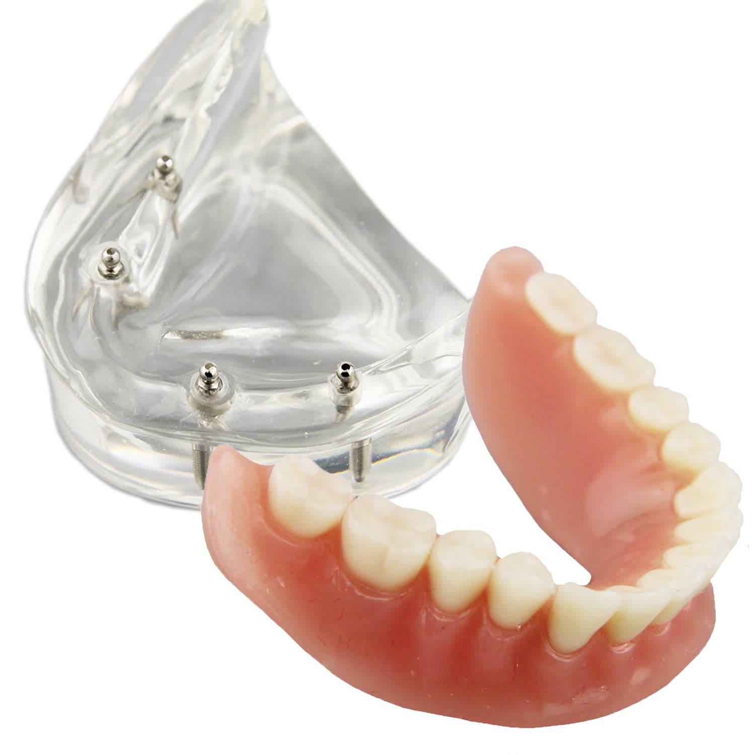 Dental Model Overdenture Inferior 4 Implants Demo for Teaching and Studying